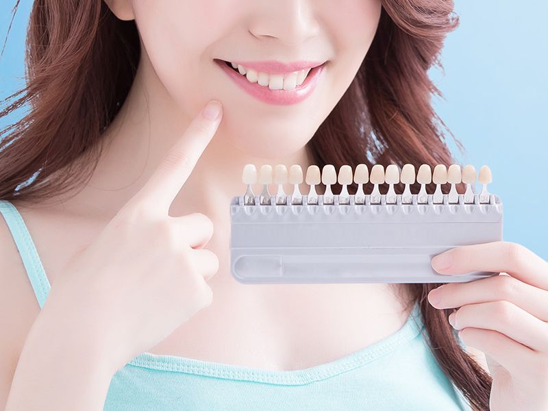 美齒貼片 美齒貼片