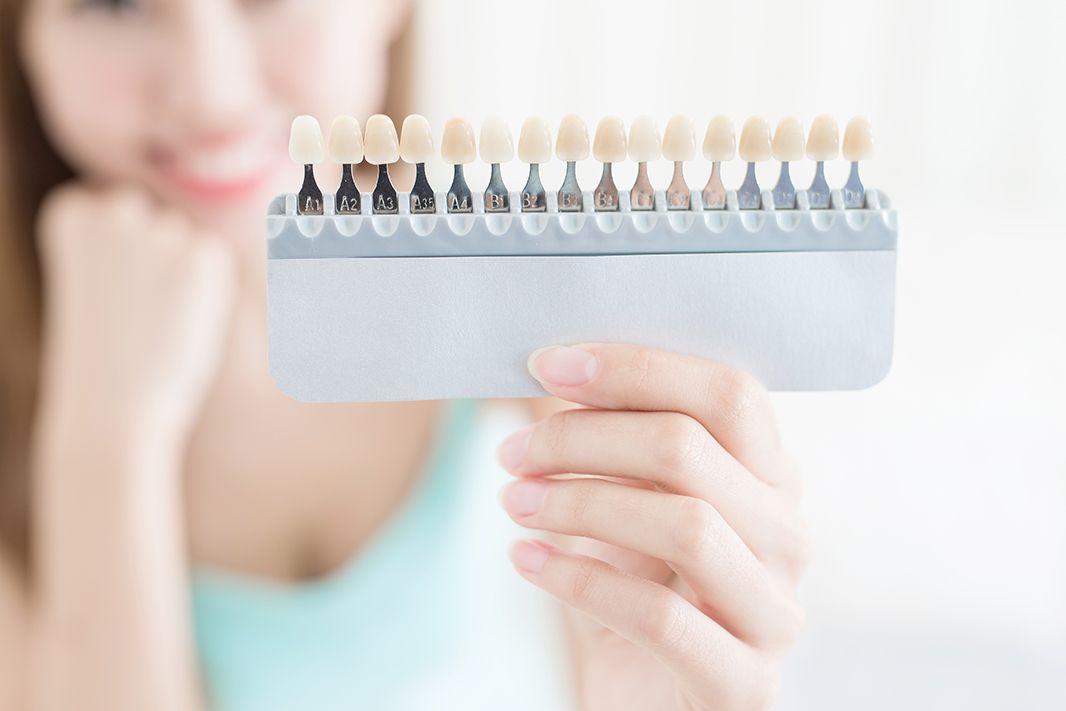 全瓷牙冠 全瓷牙冠